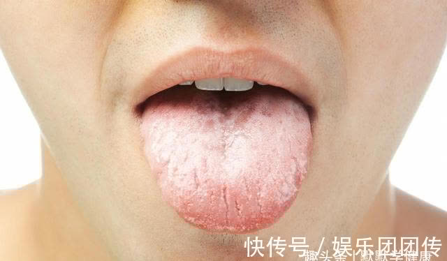 桂圆肉|伏天是补阳、祛痰湿的好时机,这3招,阳虚、痰湿重的人别错过!