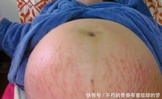 高龄|42岁高龄孕妇剖腹产6胞胎，看着孩子们性别，产科医生都惊讶了