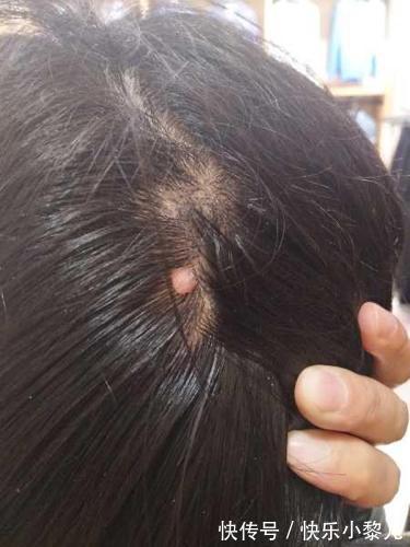 小帅|4岁孙子睡觉总捂着头,奶奶半夜扒开头发,忍不住掉下眼泪