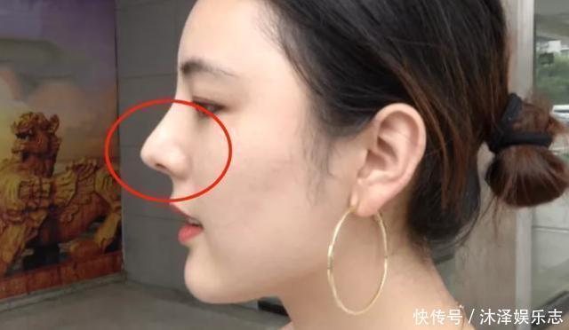 女主播花十几万整形,“鼻毛都能看见”,医院要求太高了!