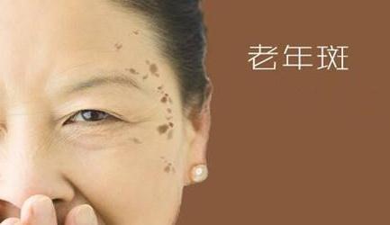防晒|为啥有的人老年斑一大片,有人却没有如何预防老年斑