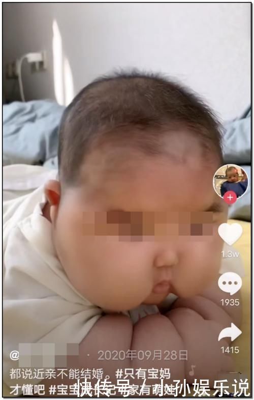 剂量|惊人反转?宝宝被大剂量涂抹面霜?大头娃娃父母被质疑了!
