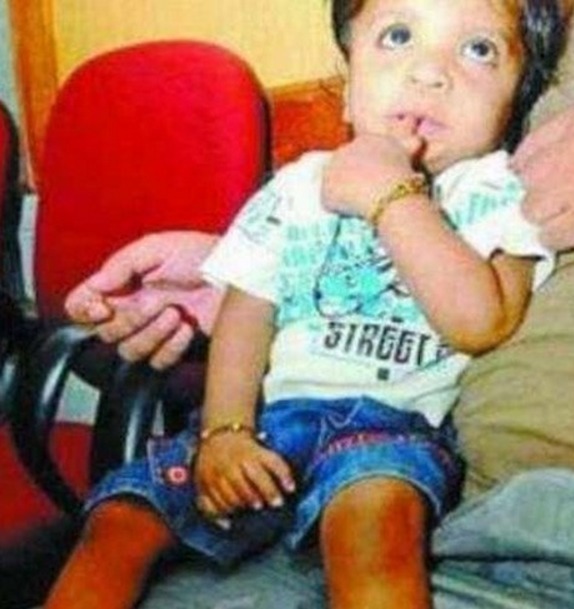 吉尼斯世界纪录|小孩指头竟有34个,打破了吉尼斯世界纪录