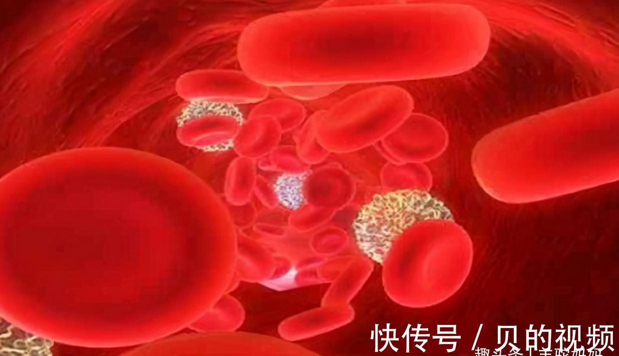 喂养|每3个2岁以内的孩子中,就会有一个缺铁性贫血,喂养出错太伤娃