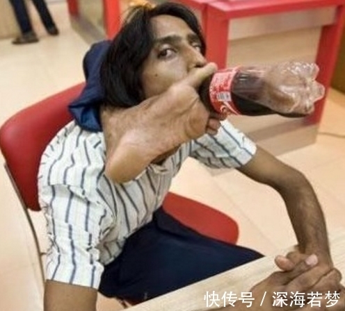 男孩|印度男孩胳膊能够绕到身体后面,韧性极强的“橡胶人”,厉害了