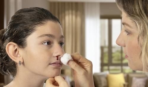 粘膜|孩子经常流鼻血预示身体出现哪些问题呢?医生详细告诉你