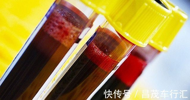 孩子|脐带血=救命血?伴随孩子降生的这份“礼物”,到底要不要留存?