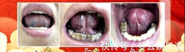 痰湿|血瘀生百病!中医推荐4个活血化瘀宝贝,针对不同的血瘀体质!