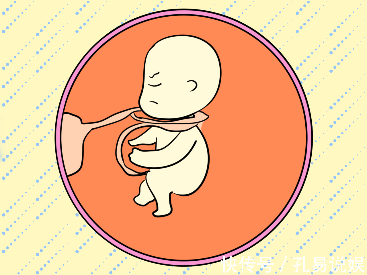 胎儿|脐带绕颈的发生率为20孕妈先别慌,处置妥当胎儿会自行脱困!