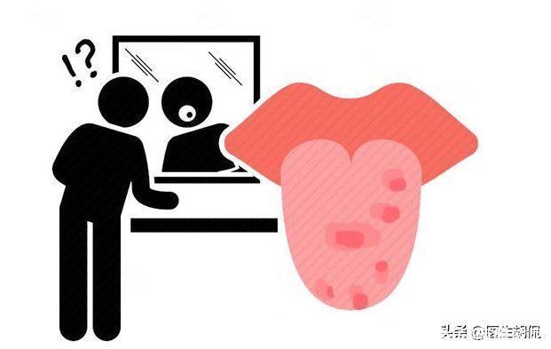 口腔溃疡|不是口腔疾病,而是癌症信号?无论男女,当心口腔这2种异常表现
