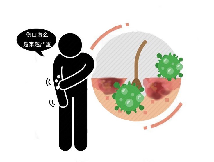 内脏|到底喝冷水好,还是热水更健康?医生告知:喝这种水,5种好处