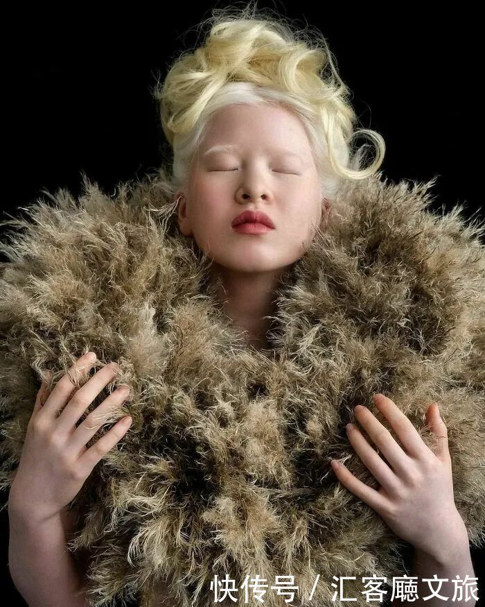 逆袭|因“全身雪白”被遗弃的中国女孩,逆袭成超模的故事让人泪目