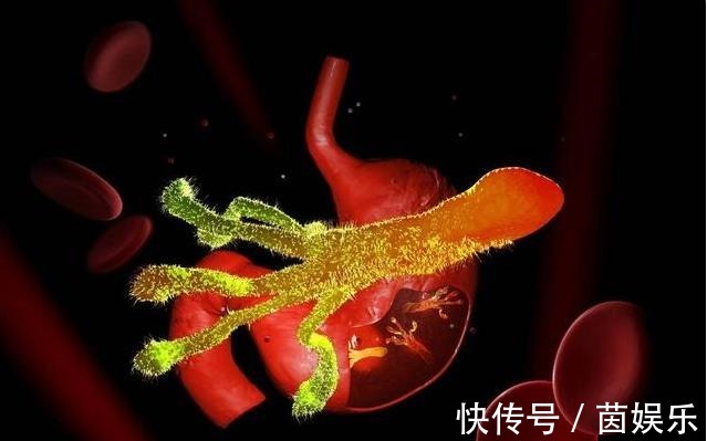 抑制幽门螺杆菌|2种常见食物,能“吃掉”幽门螺杆菌,家里常备,能远离胃炎