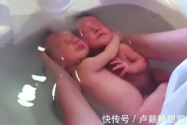 宝宝|刚出生的龙凤胎就一直亲,护士都分不开,画面实在太暖心了