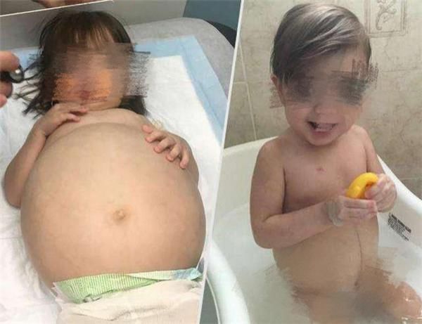 跳高跳远|女孩肚子奇大,医院检查竟发现腹中有“孩子”,得知真相父母崩溃