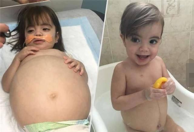 a533|3岁女儿重病濒死，爸爸狠心一个决定，见过大场面的医生都哭了