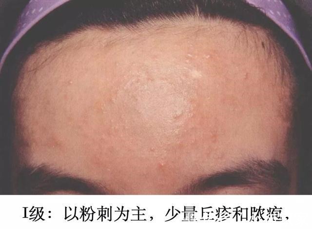 护肤品 哪些皮肤问题是护肤品不能解决的!