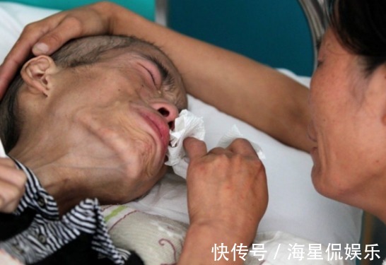 癌细胞|“一级致癌物”被发现了,粘上就是癌细胞,却是多数人的最爱