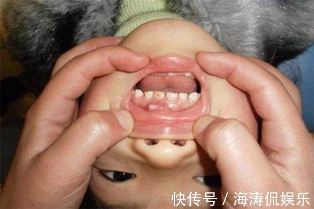 女儿|家里这3种东西,比糖更易让孩子长出“黑牙”,家长应该了解