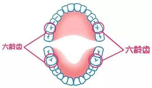 乳牙|妈妈们注意了，6成儿童蛀牙都发生在这牙上~