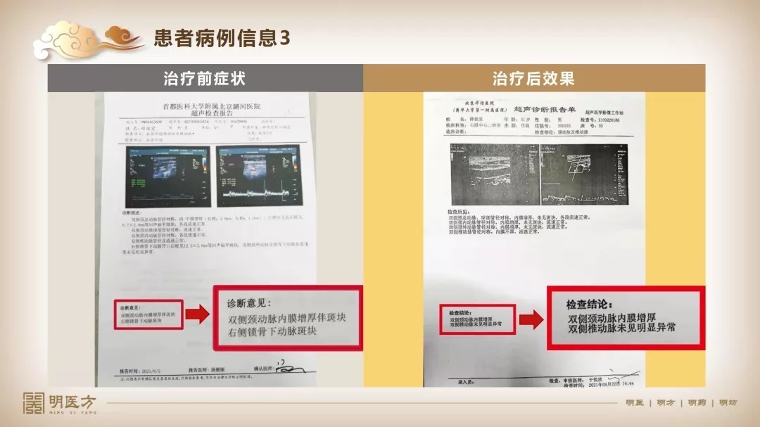 内膜|因为高血压进了ICU！别再拿高血压不当回事儿