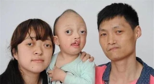 缺点|有一种遗传叫“不放过爸妈每一个缺点”,网友:连奶奶也不放过