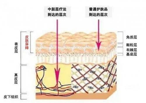 一篇文带你了解中胚层疗法