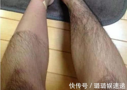 旺盛|为何有人腿毛旺盛,有人却“光溜溜”?女护士说出3因素,贼真实