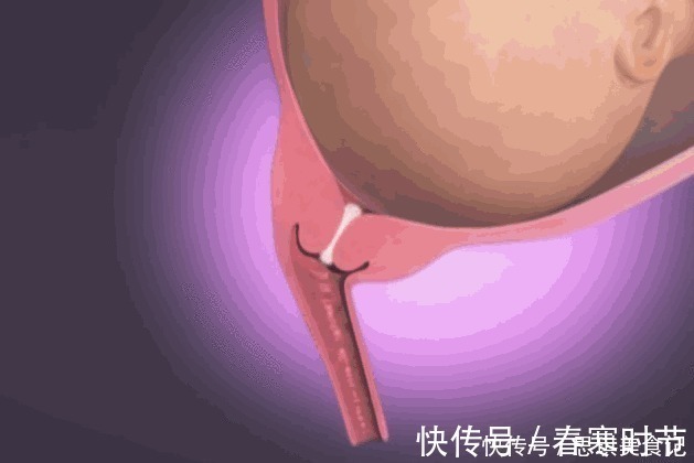 宝宝|生孩子到底有多痛?10张图告诉你:宝宝如何一步步来到这个世界