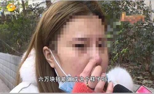 女子花60000整容,术后却整成“凹陷鼻”,找其理论主刀医生闭门不见