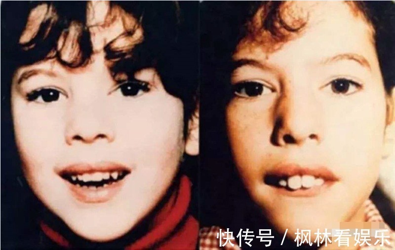 呼吸|孩子每次用嘴呼吸都是在“毁容”,改不掉这坏习惯,只会越长越丑