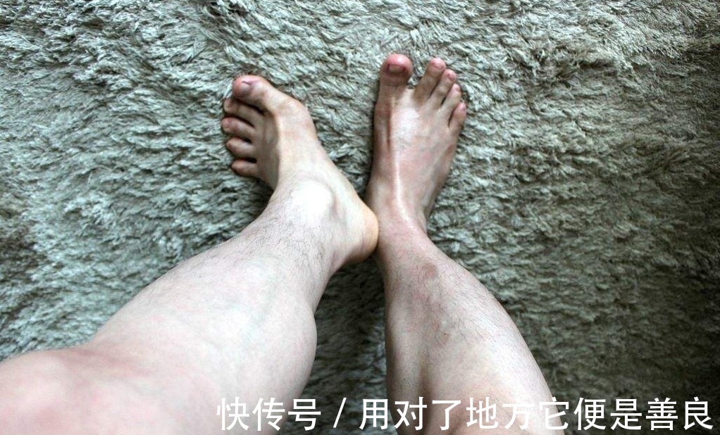 性能力|雄性激素過旺的男人，多半有兩個特征，有就不錯