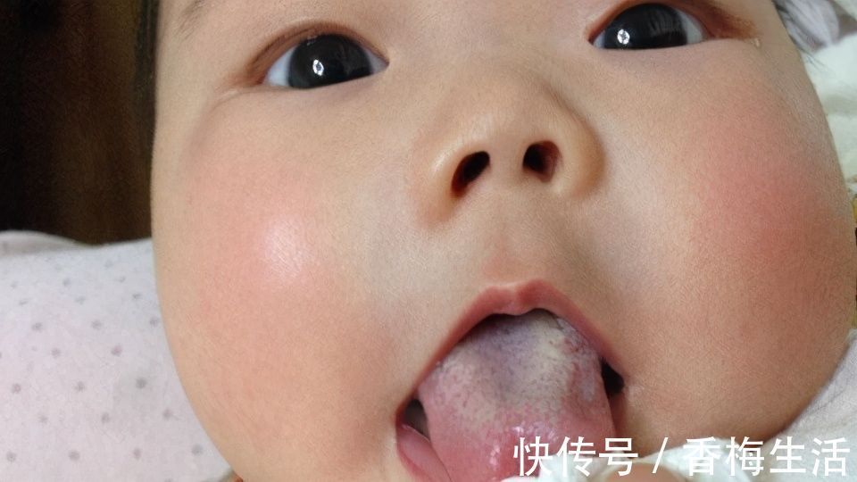 家长|孩子积食是拖出来的,脸上发现3种迹象,脾胃已经不堪负重了