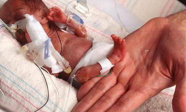 诊断|"拇指姑娘"出生时仅25厘米,被诊断活不到1岁,结果却出人意料