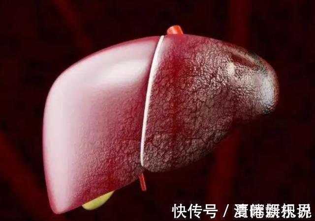 病变|肝脏变硬，头部先知医生头部若有3个表现，或提示该养肝了