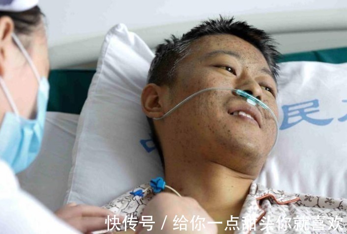 黄曲霉素|30岁男子肝癌离世,不抽烟不喝酒,只因味2种食物吃太多