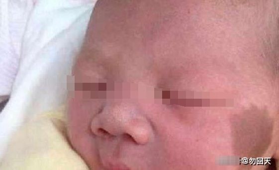 孕妈们|孕妈怀孕后，几件事要注意，容易在宝宝身上留下“胎记”！