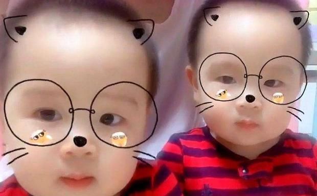 弟弟|双胞胎弟弟吃母乳,哥哥吃奶粉,5个月后差距明显,网友大呼心疼