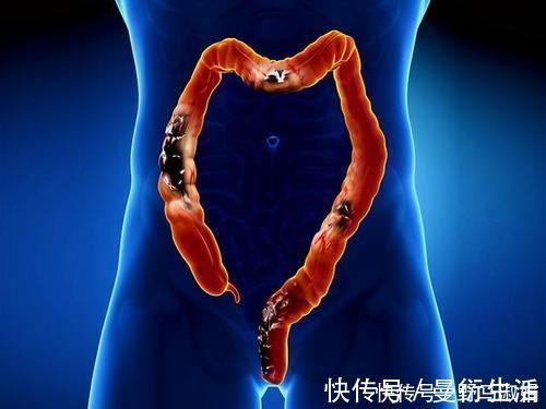 润肠|便秘让人烦恼,但身边这3种饮食有润肠、通便的作用,不妨来看看