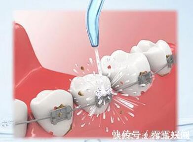 口腔|为什么牙缝里掏出来的东西很臭这些方法可以解决