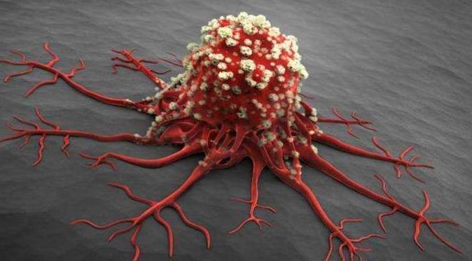 常吃“腐乳”的人,会有什么变化多数人还不清楚,答案让人意外