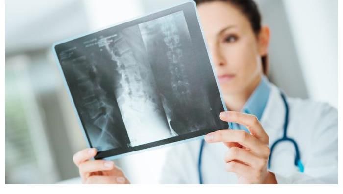 骨骼|55岁大姐常吃1物,骨骼变强壮,骨科医生:她的经验值得好好学习