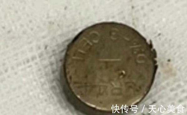 纽扣电池|男童好奇误吞纽扣电池后送医,家长觉得没大碍直接抱回家
