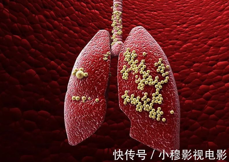 离世|26岁女教师确诊肝癌,不幸离世,医生叹息:这种“水杯”怎可常用