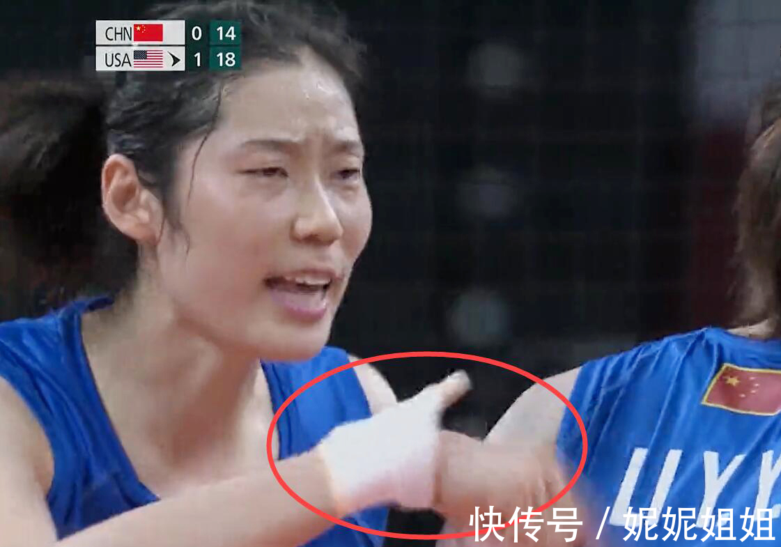 队长|中国女排队长让人泪目!夹板翘起朱婷不知 郎平铁血队长尽力啦