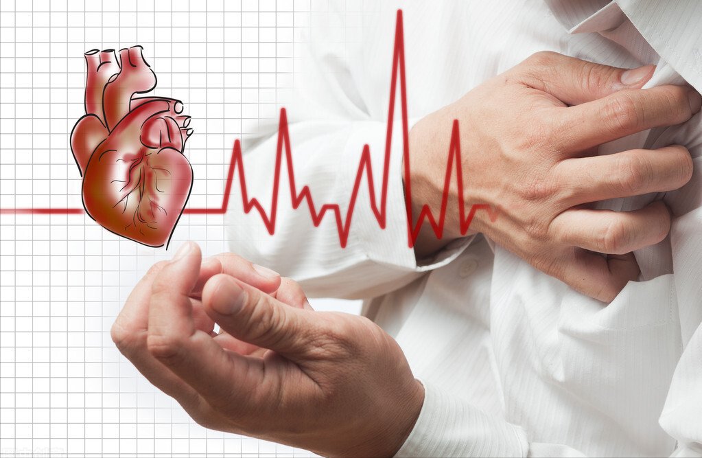 三七|冠心病心绞痛,根在血脉不通,2个成药理气活血化瘀,保护心血管