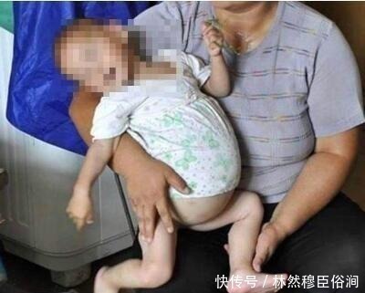 医生|2岁宝宝肚子差点胀破,医生查出肚里东西,爸爸妈妈差点受不了