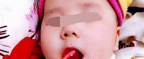 母乳|五个月女婴双肾长满结石,只因刚出生三天,父母就开始做这件事