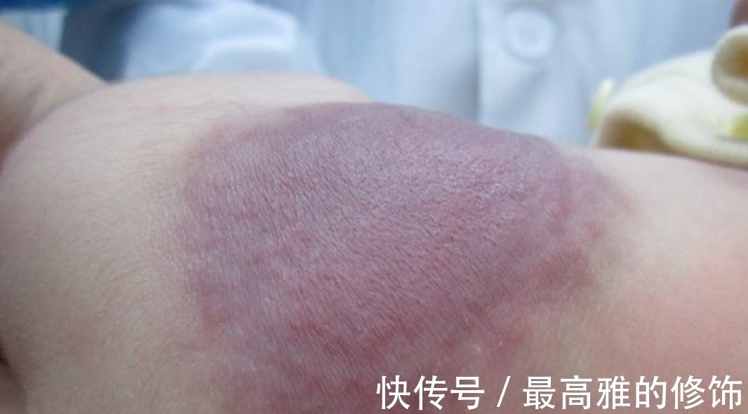 润肤霜|不满三周岁的宝宝,身上这三个部位仍然很脆弱,宝妈要尽量保护好