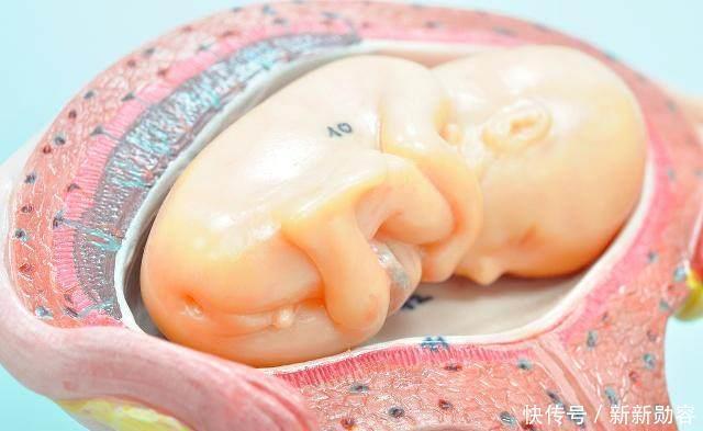 怀孕时,有的孕妈肚子大得像球,有的却不显怀,多半是这4个原因